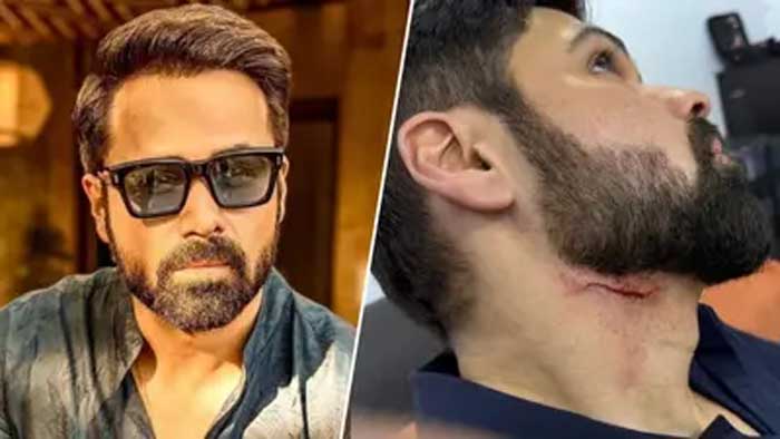 ഗൂഡാചാരി 2 സെറ്റില്‍ അപകടം; ബോളിവുഡ് താരം ഇമ്രാന്‍ ഹാഷ്മിക്ക് കഴുത്തിന് പരിക്ക്