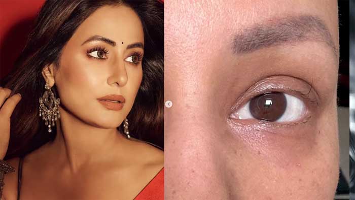 പിടിച്ച് നില്‍ക്കുന്ന അവസാന കണ്‍പീലി'; എന്റെ ഇപ്പോഴത്തെ പ്രചോദനത്തിന്റെ ഉറവിടം; കാന്‍സര്‍ ചികിത്സയ്ക്കിടെയുള്ള ചിത്രം പങ്കുവെച്ച് ഹിന ഖാന്‍.