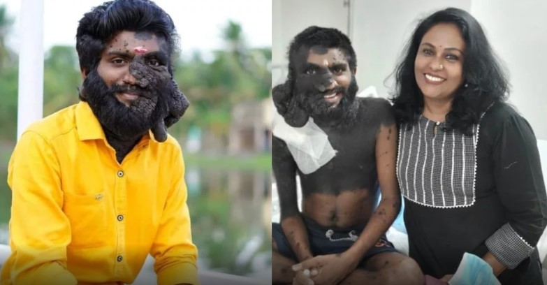  വേദനയിലും ചിരിയോടെ എന്നെ സ്വീകരിച്ചു;സ്വപ്നങ്ങളും പ്രതീക്ഷകളും ഏറെയുണ്ടായിരുന്ന രാജകുമാരന്‍; . സ്‌നേഹിക്കുന്നവര്‍ ഓരോരുത്തരായി കൊഴിയുന്നു; പ്രഭുലാലിന്റെ മരണത്തില്‍ വേദന പങ്ക് വച്ച് സീമ ജി നായര്‍