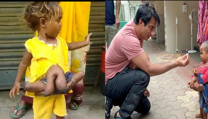 ശസ്ത്രക്രിയ വിജയകരമായി പൂര്‍ത്തിയായി;നാലു കയ്യും നാലു കാലുമായി ജനിച്ച കുഞ്ഞിന്  സഹായവുമായി സോനൂ സൂദ്