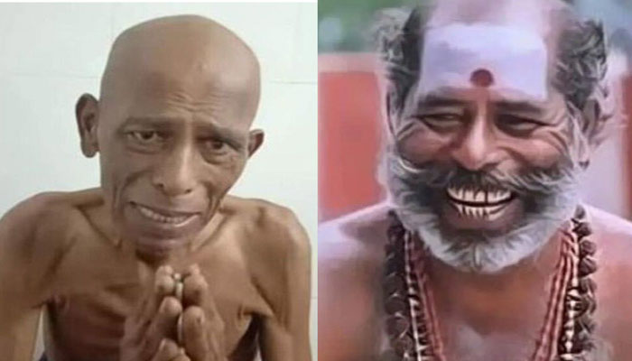 കാൻസർ കവർന്ന  അഭിനയ ജീവിതം;  തിരിച്ചറിയാൻ പോലും കഴിയാത്ത അവസ്ഥ; നടൻ തവസിയുടെ ആരോഗ്യസ്ഥിതി ദയനീയം 